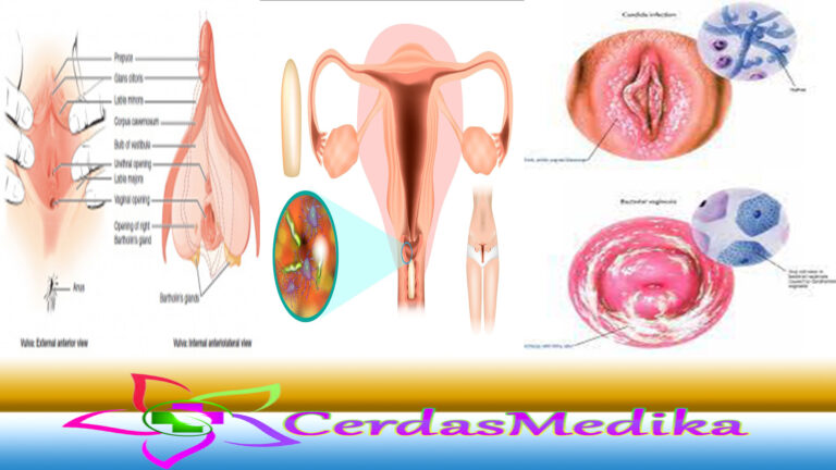 Mengenal Penyebab Vulvovaginitis Beserta Gejalanya