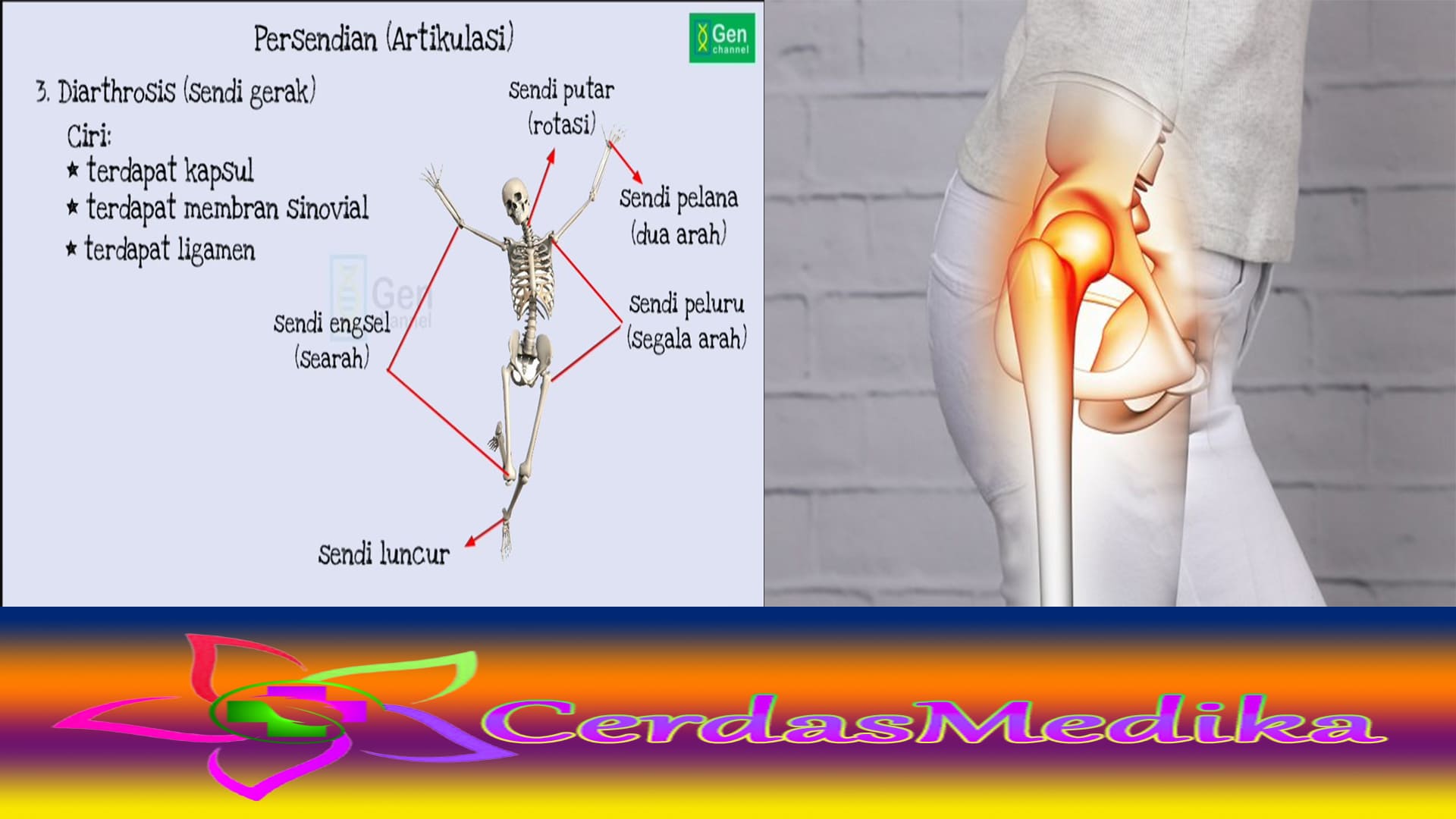 Mengenali Sendi Peluru dan Resiko Penyakit nya