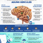 Mengapa Glioblastoma Sebabkan Otak Terganggu?