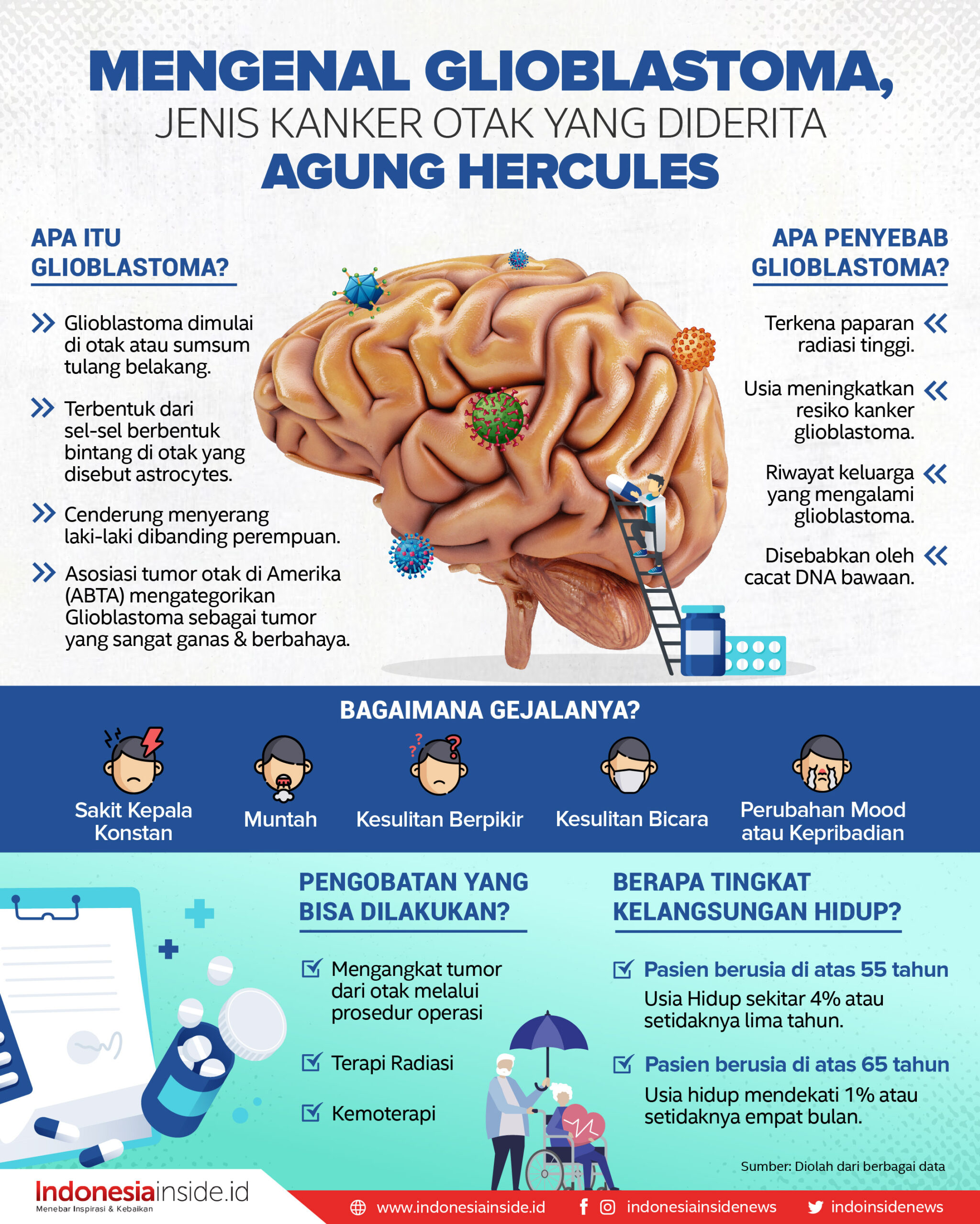 Mengapa Glioblastoma Sebabkan Otak Terganggu?