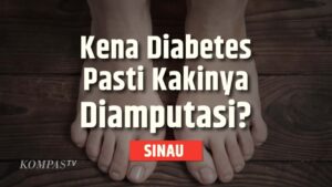 Mengenal Luka Diabetes